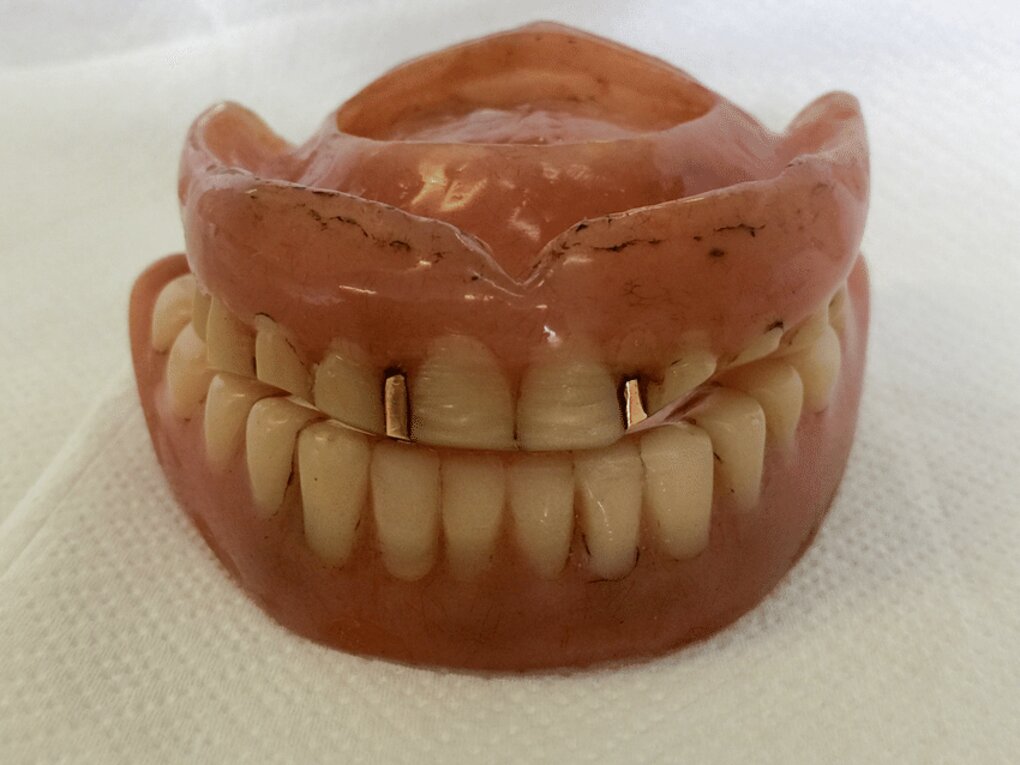 Old Dentures for sale in UK 29 used Old Dentures